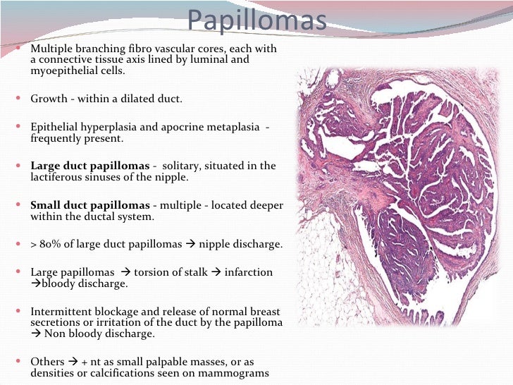 breast in papilloma Lou and sex